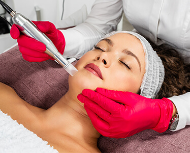 PRP Microneedling Vienna, VA