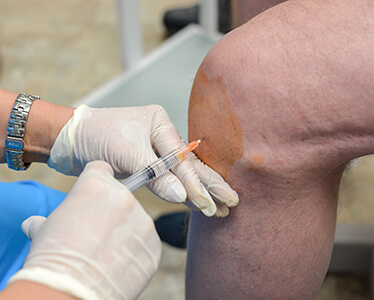 What Is Regenerative Medicine? Vienna, VA