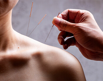 Acupuncture Clinic Vienna