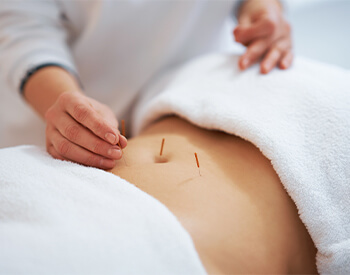 Acupuncture for Infertility Vienna