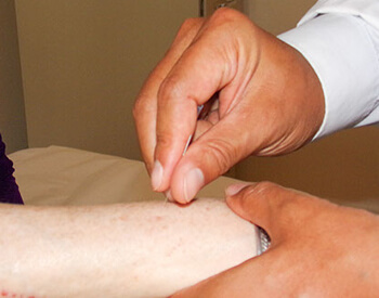 Licensed Acupuncturist McLean