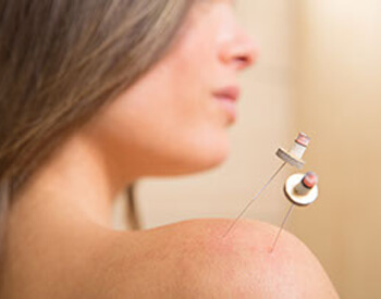 Moxibustion Treatment Vienna